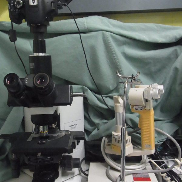 顕微鏡とスリットランプ